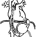 LVAD weaning experiment